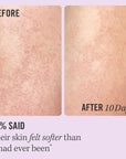 KP Bump Eraser Body Scrub with 10% AHA