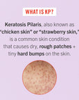 KP Bump Eraser Body Scrub with 10% AHA