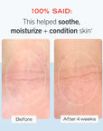 Sensitive Skin Starter Kit