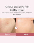 PDRN Pink Hyaluronic Moisturizing Cream