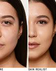 Skin Realist - 2 Light