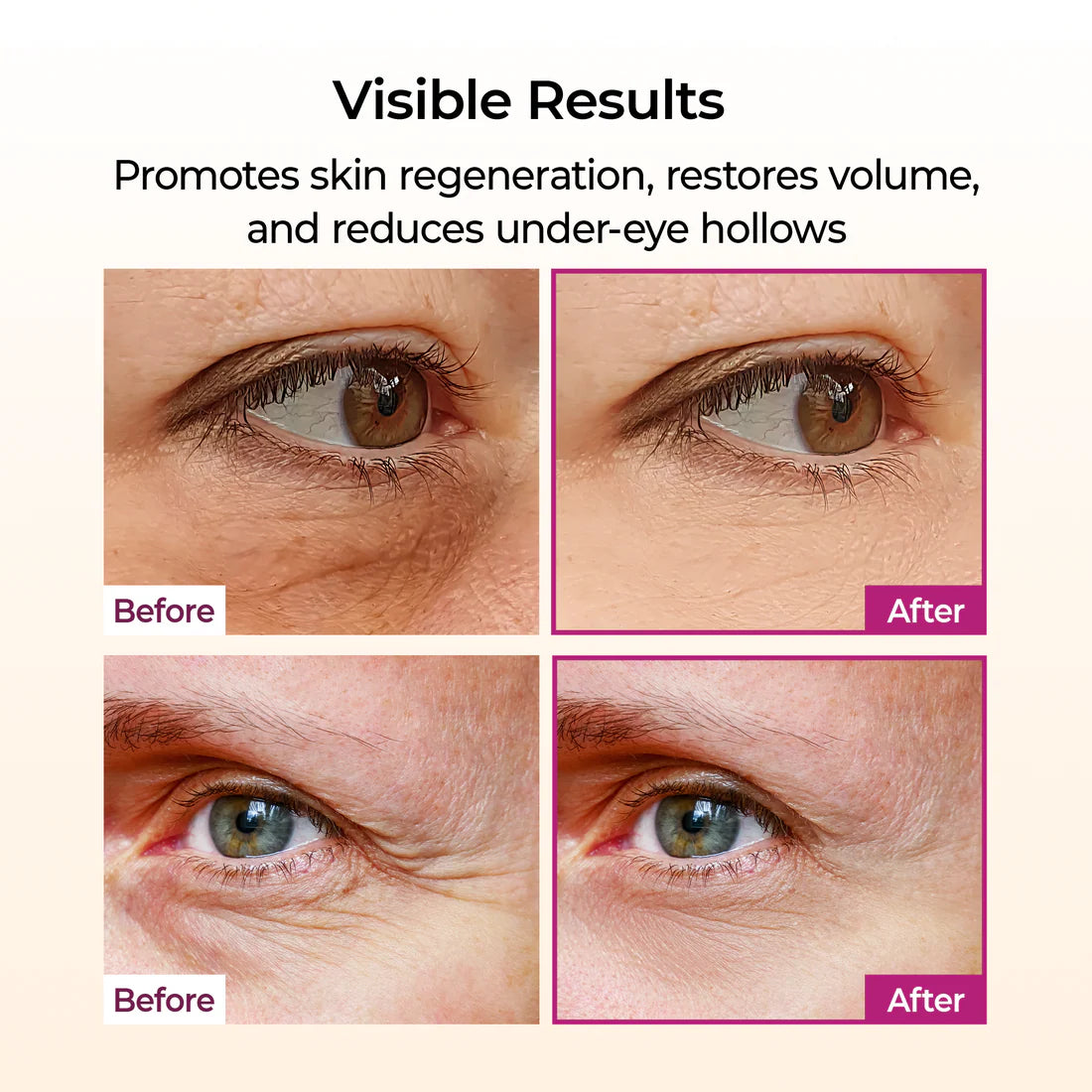 Dr. Melaxin - Cemenrete Calcium Volume Multi Balm