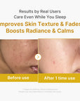 Medicube – Kojic Acid Turmeric Night Wrapping Mask