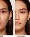 Skin Realist - 2.5 Medium