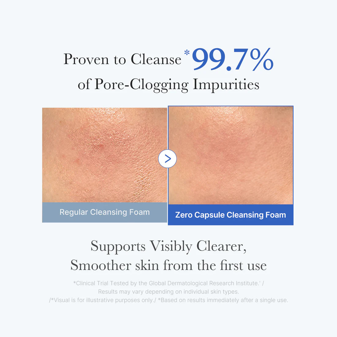 Medicube - Zero Pore SA Clearing Capsule Cleansing Foam