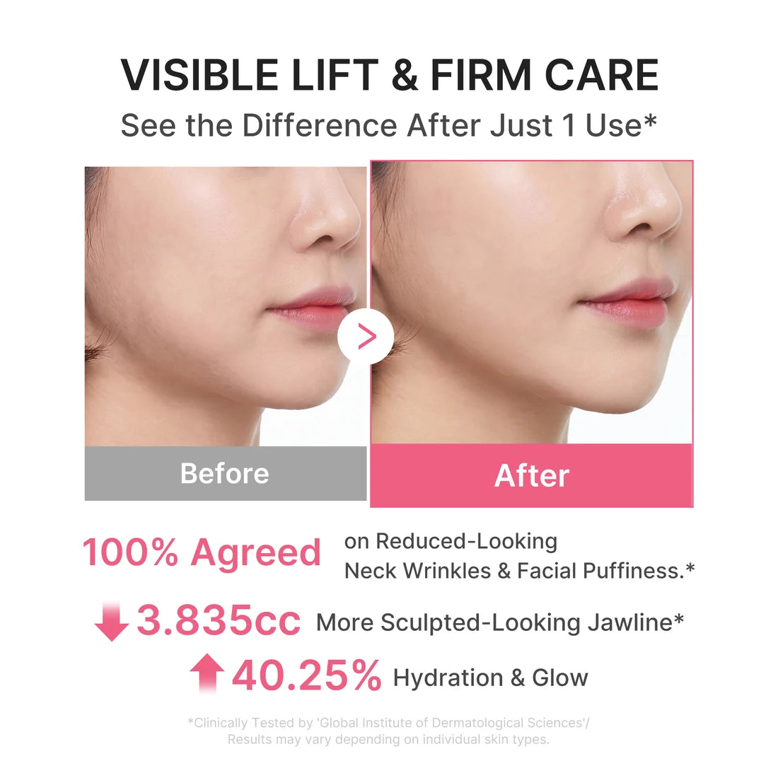 Medicube - PDRN Collagen Gua Sha Neck Wrinkle Cream