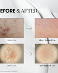 VT Cosmetics - Reedle Shot 100