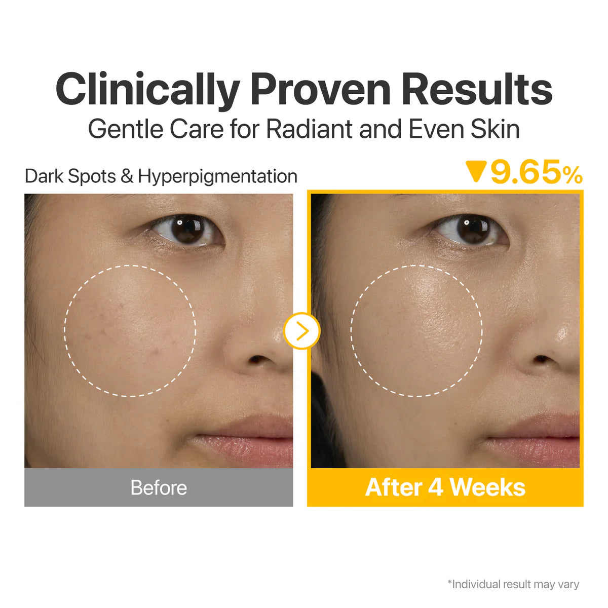 numbuzin - No.5+ Glutathione Vitamin Concentrated Serum
