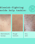 Glycolic Body Scrub