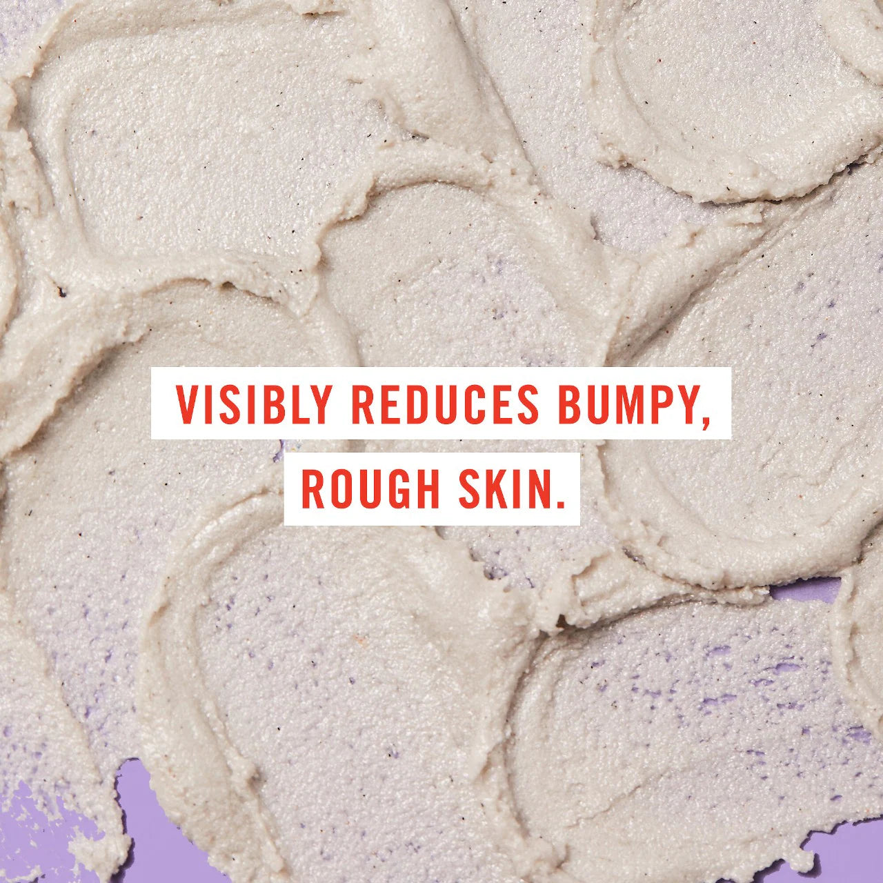 KP Bump Eraser Body Scrub with 10% AHA