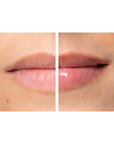 Diamond Lip Plumper - Marquise