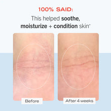 Load image into Gallery viewer, Sensitive Skin Starter Kit
