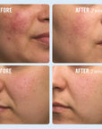 Ultra Repair Cream, 170gr