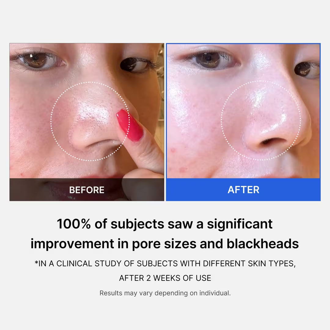 Zero Pore Pads