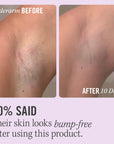 Ingrown Hair Pads with BHA & AHA